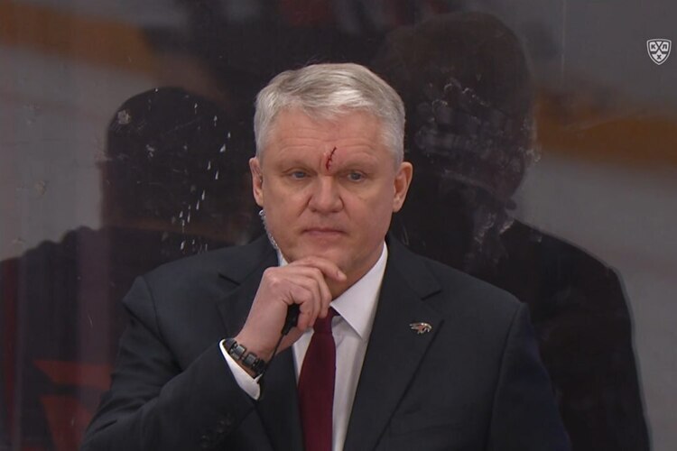 Тренеру «Авангарда» и экс-игроку «Ак Барса» наложили четыре шва прямо во время матча