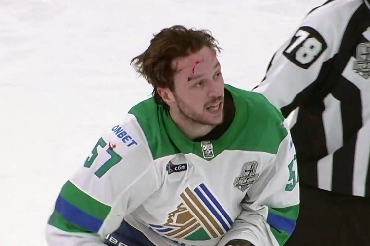 Боль первого матча «Салавата Юлаева» в Кубке Гагарина: в Сучкова попали шайбой, Броссо разбили голову 